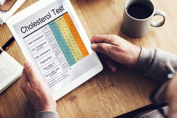 Cholesterol Report Test